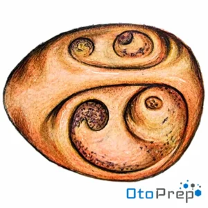 OtoPrep Internal Acoustic Meatus anatomy