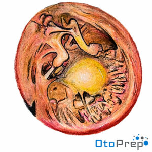 OtoPrep Right Middle Ear Endoscopic Anatomy