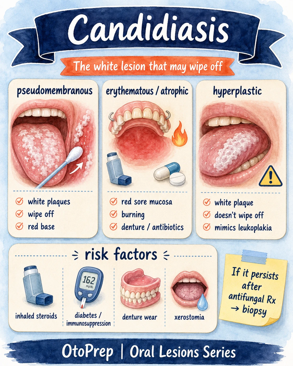 Oral candidiasis infographic showing pseudomembranous, erythematous atrophic and hyperplastic candidiasis with risk factors.