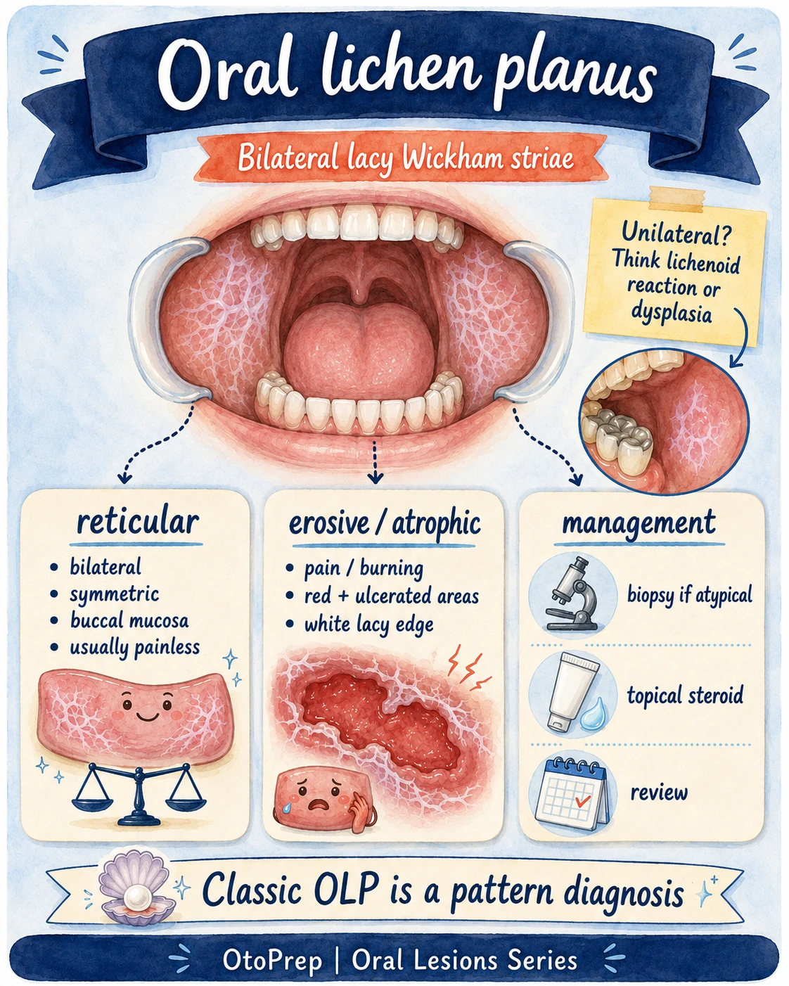 Oral lichen planus infographic showing bilateral lacy Wickham striae, reticular and erosive atrophic patterns and management.