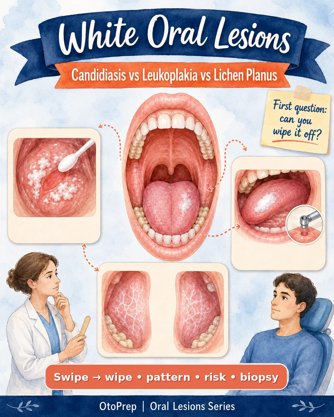 White oral lesions overview comparing oral candidiasis, leukoplakia and oral lichen planus with a wipe test approach.